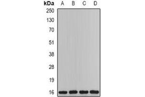 Image no. 2 for anti-6-Pyruvoyltetrahydropterin Synthase (PTS) (full length) antibody (ABIN6005316)