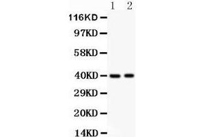 Image no. 2 for anti-Interferon Regulatory Factor 4 (IRF4) (AA 272-451) antibody (ABIN3042469)