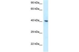 Image no. 1 for anti-RNA Binding Motif Protein, X-Linked (RBMX) (AA 314-363) antibody (ABIN6747638)
