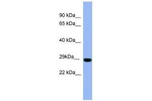 Image no. 1 for anti-RAB1A, Member RAS Oncogene Family (RAB1A) (Middle Region) antibody (ABIN631433)