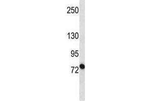 Image no. 1 for anti-ATP-Binding Cassette, Sub-Family B (MDR/TAP), Member 10 (ABCB10) (AA 1-27) antibody (ABIN3030047)