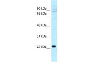 Image no. 1 for anti-C-Type Lectin Domain Family 5, Member A (CLEC5A) (AA 110-159) antibody (ABIN6747837)