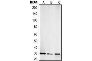 Image no. 2 for anti-Toll Interacting Protein (TOLLIP) (Center) antibody (ABIN2707189)