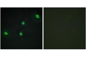 Image no. 2 for anti-Cell Division Cycle Associated 4 (CDCA4) (AA 121-170) antibody (ABIN1534323)