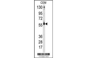 Western Blotting (WB) image for anti-Cytochrome P450, Family 2, Subfamily C, Polypeptide 9 (CYP2C9) antibody (ABIN2158449)