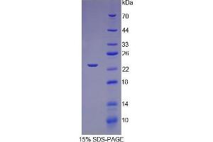 Image no. 1 for Troponin I Type 1 (Skeletal, Slow) (TNNI1) (AA 1-187) protein (His tag) (ABIN1081038)