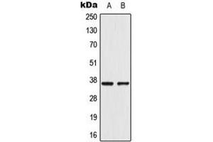 Image no. 2 for anti-Aldo-Keto Reductase Family 1, Member E2 (AKR1E2) (Center) antibody (ABIN2705424)