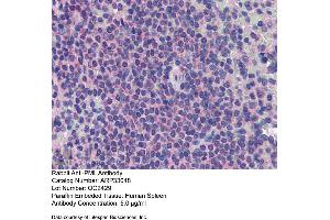Image no. 2 for anti-Promyelocytic Leukemia (PML) (C-Term) antibody (ABIN2777721)