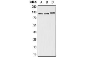 Image no. 1 for anti-ATP-Binding Cassette, Sub-Family C (CFTR/MRP), Member 11 (ABCC11) (N-Term) antibody (ABIN2707296)