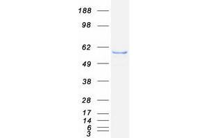 Image no. 1 for Lysophosphatidylcholine Acyltransferase 1 (LPCAT1) protein (Myc-DYKDDDDK Tag) (ABIN2724868)