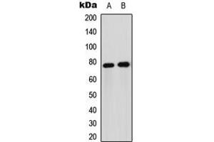 Image no. 3 for anti-Forkhead Box O1 (FOXO1) (Center) antibody (ABIN2706174)