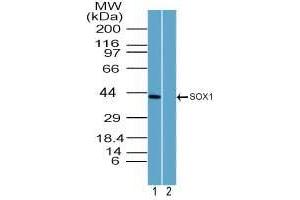 Image no. 2 for anti-SRY (Sex Determining Region Y)-Box 1 (SOX1) (AA 100-150) antibody (ABIN960348)