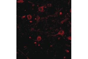 CADPS antibody  (C-Term)