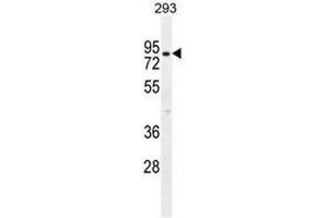 Image no. 3 for anti-ClpX Caseinolytic Peptidase X (CLPX) (AA 452-481), (C-Term) antibody (ABIN951581)