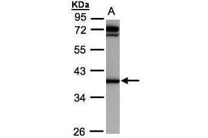 Image no. 4 for anti-Dihydrodiol Dehydrogenase (DDH) (Center) antibody (ABIN2856139)