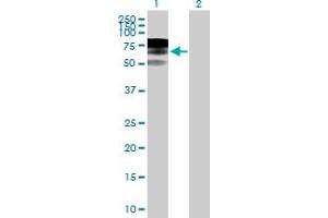 Image no. 1 for anti-Ring Finger Protein 168 (RNF168) (AA 1-571) antibody (ABIN1327735)
