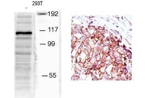 Image no. 1 for anti-Mindbomb E3 Ubiquitin Protein Ligase 1 (MIB1) (N-Term) antibody (ABIN357602)