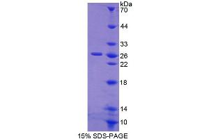 Image no. 1 for Calcineurin-Like phosphoesterase Domain Containing 1 (Cpped1) (AA 101-312) protein (His tag) (ABIN6239541)