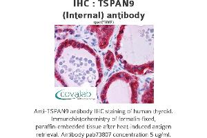 Image no. 1 for anti-Tetraspanin 9 (TSPAN9) (Internal Region) antibody (ABIN1740429)