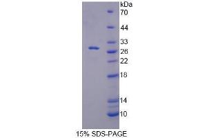 Image no. 1 for Replication Factor C (Activator 1) 5, 36.5kDa (RFC5) (AA 63-339) protein (His tag) (ABIN6239663)