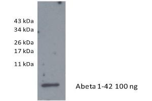 Image no. 2 for anti-Amyloid beta 1-42 (Abeta 1-42) antibody (ABIN334635)