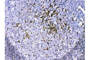 Image no. 1 for anti-Copper Chaperone For Superoxide Dismutase (CCS) (AA 174-209), (C-Term) antibody (ABIN5518744)