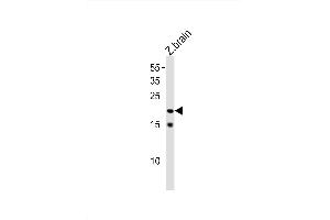 Image no. 1 for anti-Transcription Factor 21 (TCF21) (AA 5-35), (N-Term) antibody (ABIN1881873)