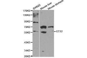 Image no. 2 for anti-Carboxylesterase 2 (CES2) (pSer2) antibody (ABIN3022048)