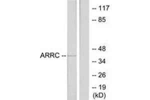 Image no. 1 for anti-Arrestin 3, Retinal (X-Arrestin) (ARR3) (AA 339-388) antibody (ABIN1534268)