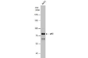 Image no. 2 for anti-T-Complex 1 (TCP1) (Internal Region) antibody (ABIN2855394)