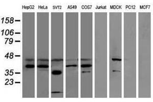 Image no. 2 for anti-Sulfotransferase Family, Cytosolic, 1C, Member 2 (SULT1C2) antibody (ABIN1501234)