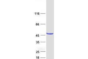 Image no. 1 for Cytohesin 4 (CYTH4) protein (Myc-DYKDDDDK Tag) (ABIN2712818)