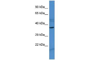 Image no. 1 for anti-Zinc Finger Protein 793 (ZNF793) (N-Term) antibody (ABIN2780977)