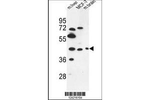 Image no. 1 for anti-Pregnancy Specific beta-1-Glycoprotein 3 (PSG3) (AA 22-50), (N-Term) antibody (ABIN653510)