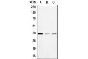 Image no. 2 for anti-BCL2/adenovirus E1B 19kDa Interacting Protein 2 (BNIP2) (Center) antibody (ABIN2705608)