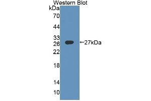 Image no. 1 for anti-Dystrophia Myotonica-Protein Kinase (DMPK) (AA 1-201) antibody (ABIN5013480)