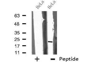 Image no. 1 for anti-Calcium Binding Protein P22 (CHP) antibody (ABIN6257590)