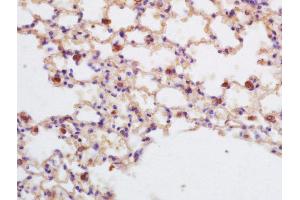 Image no. 1 for anti-Tumor Protein P53 Binding Protein 2 (TP53BP2) (AA 1001-1128) antibody (ABIN674394)