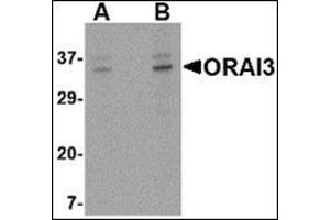 Image no. 2 for anti-ORAI Calcium Release-Activated Calcium Modulator 3 (ORAI3) (C-Term) antibody (ABIN500427)