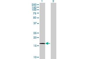 Image no. 1 for anti-HRAS-Like Suppressor (HRASLS) (AA 1-168) antibody (ABIN5580128)