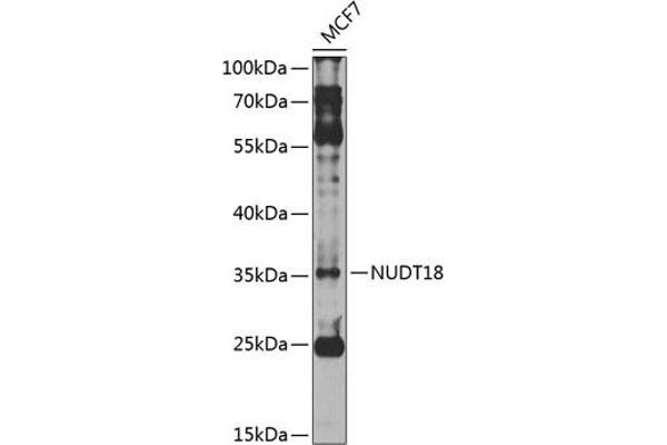 NUDT18 Antikörper  (AA 1-323)
