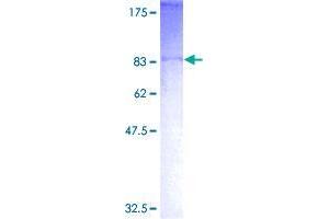 Image no. 1 for Ankyrin Repeat and SOCS Box-Containing 2 (ASB2) (AA 1-587) protein (GST tag) (ABIN1345808)