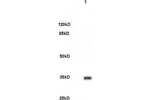Image no. 2 for anti-Pituitary Homeobox 3 (PITX3) (AA 231-302) antibody (ABIN679988)