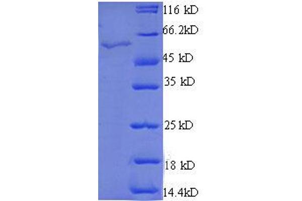 STARD7 Protein (AA 61-307, partial) (GST tag)