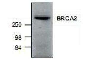 Image no. 1 for anti-Breast Cancer 2, Early Onset (BRCA2) (N-Term) antibody (ABIN223354)