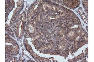 Image no. 1 for anti-V-Ets Erythroblastosis Virus E26 Oncogene Homolog 2 (ETS2) (AA 90-349) antibody (ABIN1491702)