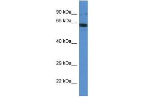 Image no. 1 for anti-Intraflagellar Transport 80 Homolog (IFT80) (C-Term) antibody (ABIN2787234)