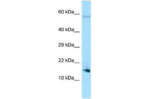 Image no. 1 for anti-Spermatid Maturation 1 (SPEM1) (N-Term) antibody (ABIN2790589)