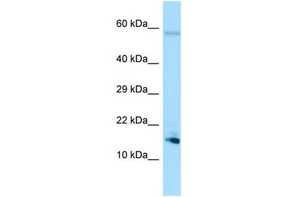 anti-Spermatid Maturation 1 (SPEM1) (N-Term) antibody