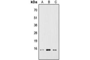 Image no. 2 for anti-Ribosomal Protein S19 Binding Protein 1 (RPS19BP1) (Center) antibody (ABIN2706989)